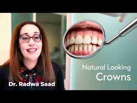 The Truth About Metal-Free crowns, Nobody is telling you