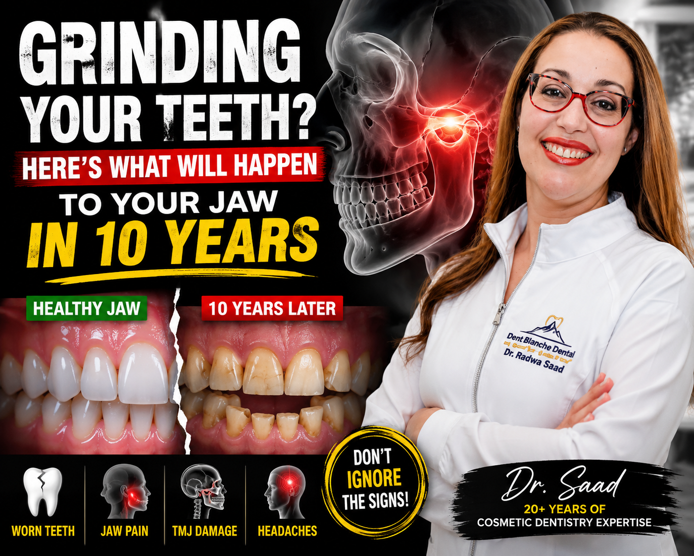 Grinding Teeth at Night: 10-Year Jaw Damage