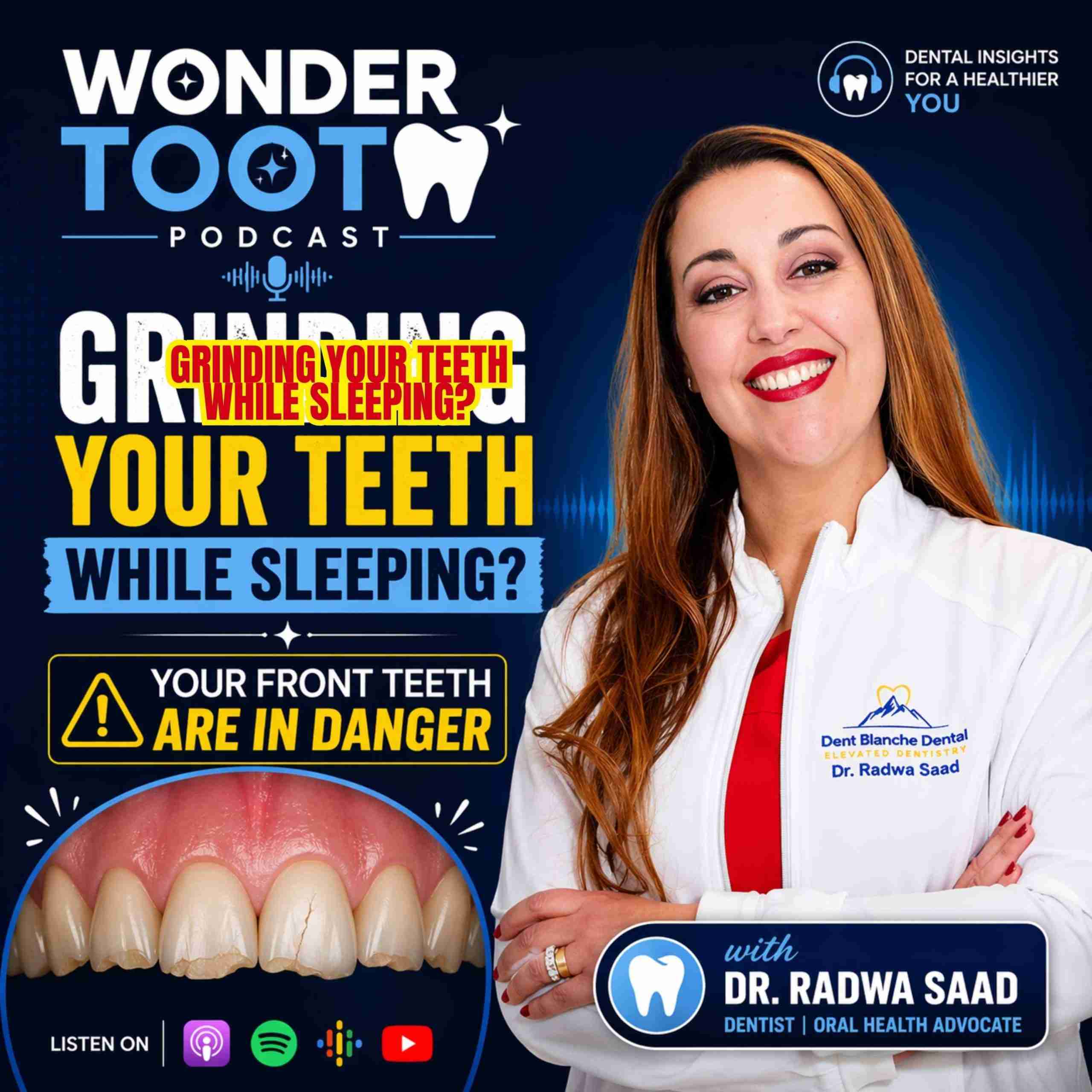 Why Are Front Teeth Fracturing? The Hidden Link to Sleep Apnea