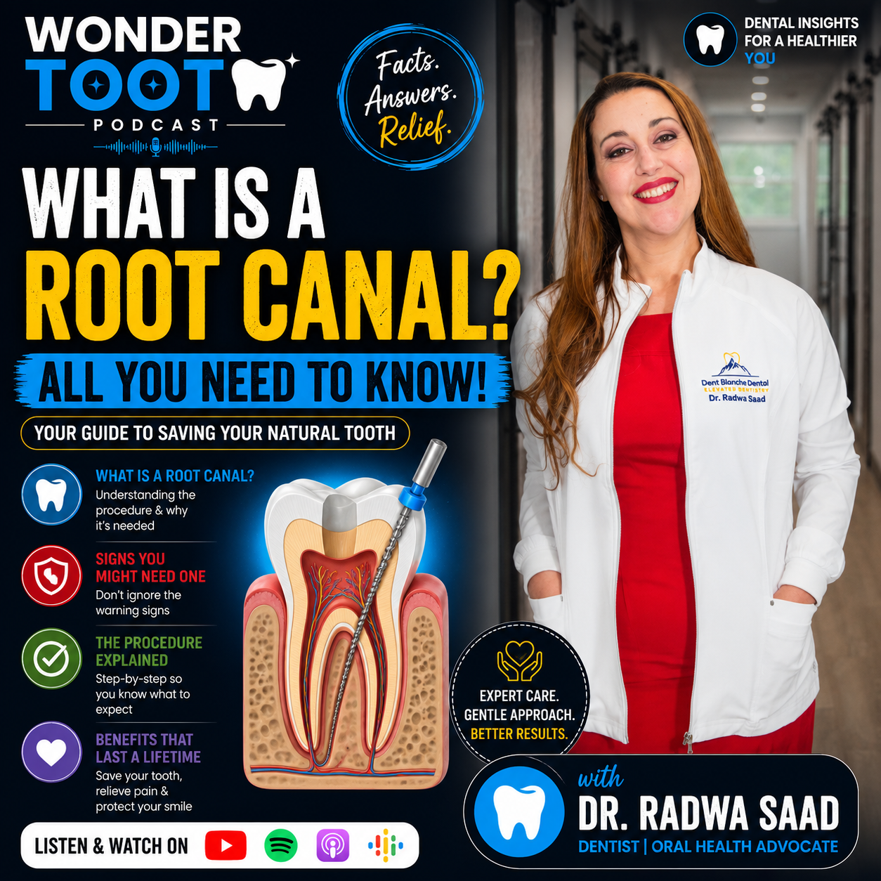 What is a Root Canal? All you need to know!
