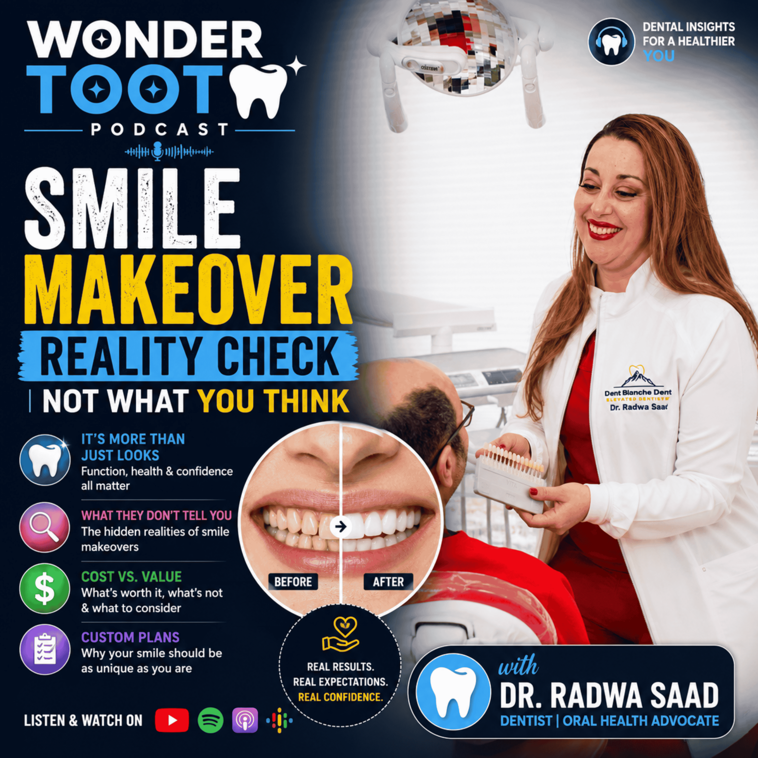 Smile Makeover Cost & What to Expect