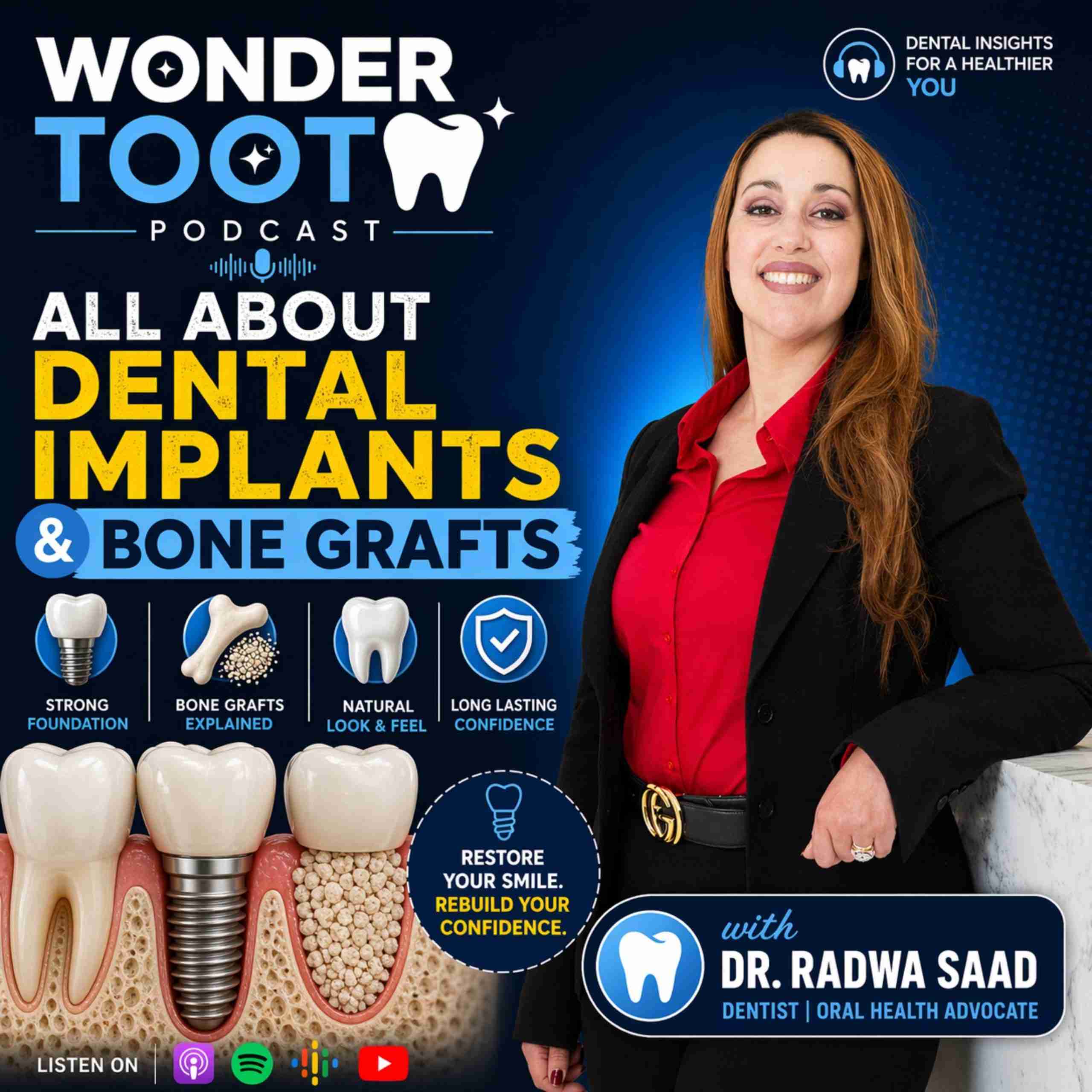 Dental Implants & Bone Grafting: How to Maintain Implants Long-Term